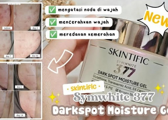 Review Moisturizer Skintific untuk Menghilangkan Dark Spot Symwhite 377, Benarkah Ampuh?