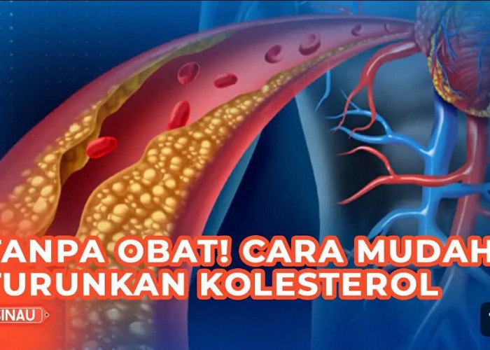 4 Cara Alami Menurunkan Kolesterol Jahat Tinggi dan Gampang untuk Dilalukan