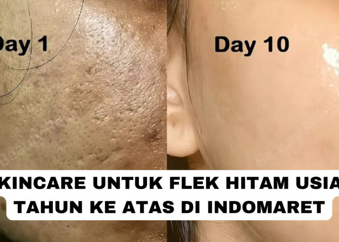 4 Skincare untuk Flek Hitam Usia 40 Tahun Ke Atas di Indomaret, Cocok untuk Mengecilkan Pori-Pori Agar Glowing