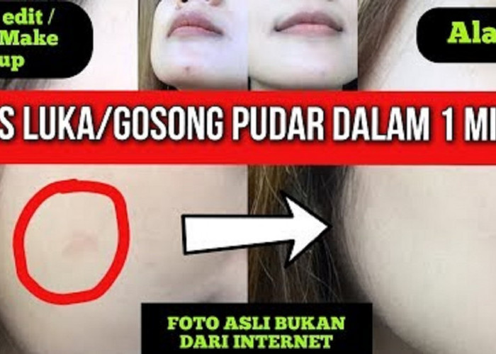 Cara Cepat Menghilangkan Bekas Luka Hitam dan Bekas Koreng Pakai Bahan Dapur, Kulit Putih Mulus Alami