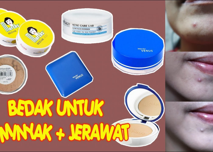 4 Merk Bedak Lokal Jadul yang Bagus untuk Wajah Berjerawat dan Berminyak Supaya Halus Seharian 