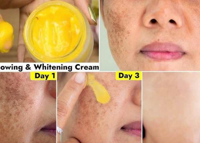 DIY Krim Pemutih Wajah Penghilang Flek Hitam dalam 1 Malam, Bikin Glowing dan Tampak 10 Tahun Lebih Muda