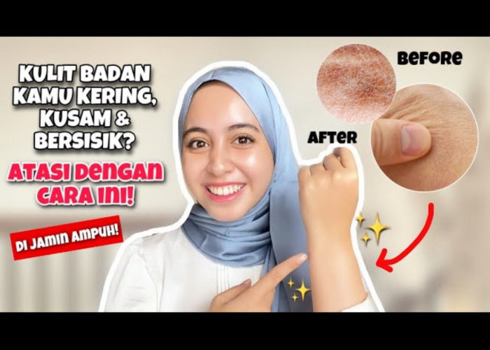 Puasa Bikin Kulit Kering? Rekomendasi Lotion untuk Kulit Kering dan Bersisik ini Bikin Kulit Lembap dan Cerah