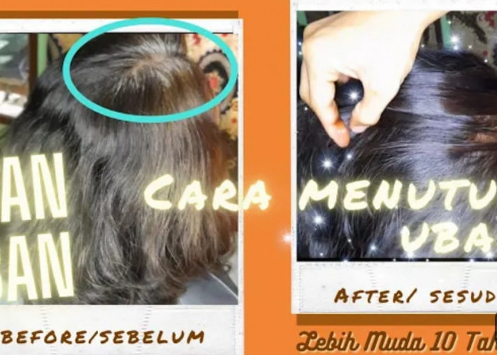 3 Cara Menghitamkan Rambut Uban Tanpa Menggunakan Shampo Dalam Sekali Usap, Rambut Putih Hilang Selamanya