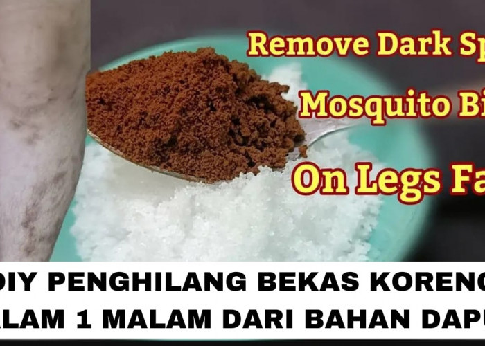 Diy Penghilang Bekas Koreng Hitam Dalam 1 Malam, Kulit Langsung Mulus Glowing Cuma Tambah 1 Bahan Ini