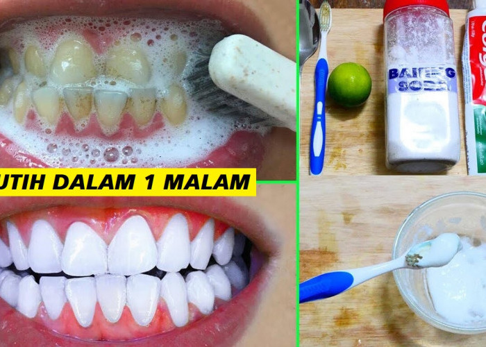 Inilah Cara Memutihkan Gigi Kuning yang Berkarang secara Alami dalam 1 Hari, Gigi Putih Bersih Aman Bebas Noda