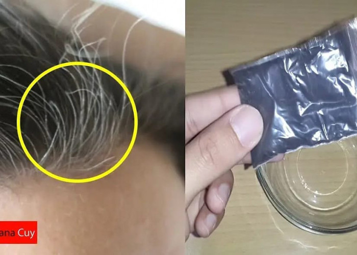 4 Cara Mengatasi Rambut Uban di Usia Muda Secara Alami Agar Hitam Permanen