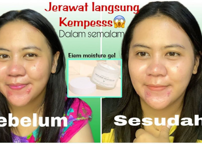 Review Eiem Beauty Water Bank Moisturizer,  Modal 30 Ribuan Bikin Kulit Cerah dan Lembut