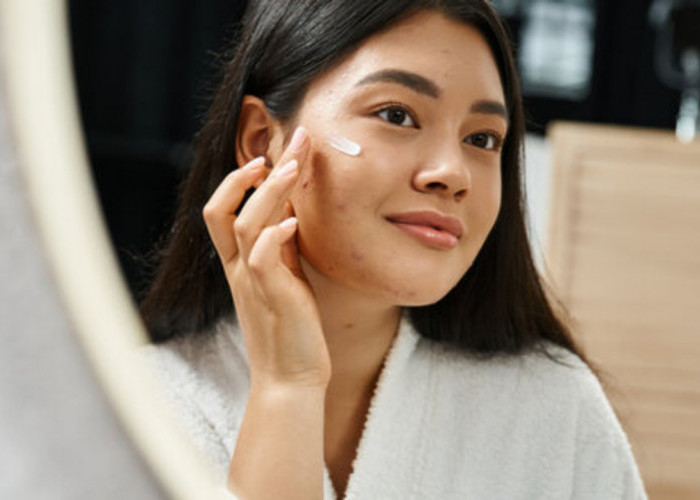 Top 5 Skincare Untuk Kulit Berjerawat BPOM, Dijamin Aman Bebas Iritasi