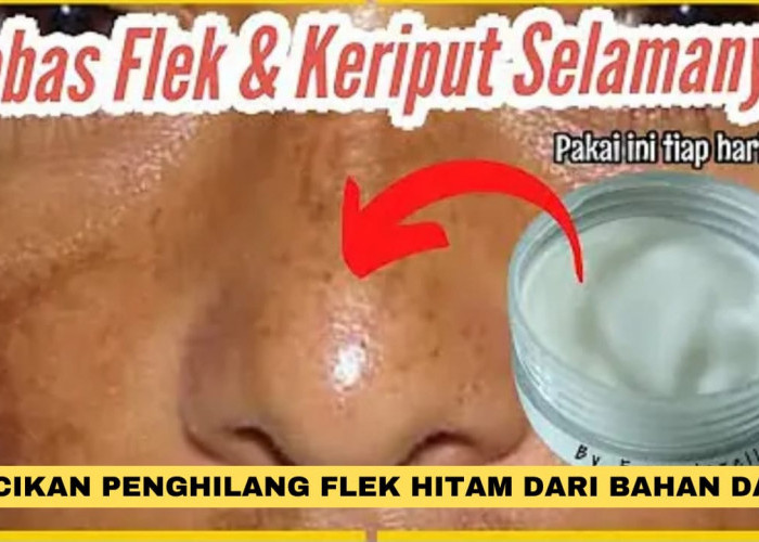 2 Racikan Cream Penghilang Flek Hitam dari Bahan Dapur, Ampuh Pudarkan Noda Hitam Kulit Langsung Glowing!