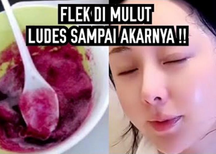 DIY Racikan Pengelupas Flek Hitam Dari Bahan Dapur, Begini 3 Cara Meraciknya