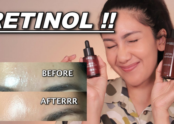 4 Rekomendasi Serum Retinol Brand Lokal yang Bagus untuk Pemula, Ampuh Atasi Penuaan Dini! Tertarik Coba?