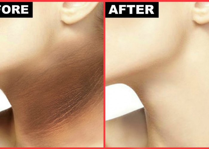 Begini Cara Mencerahkan Leher yang Hitam, Cukup Pakai 2 Jenis Bahan Alami Ini 