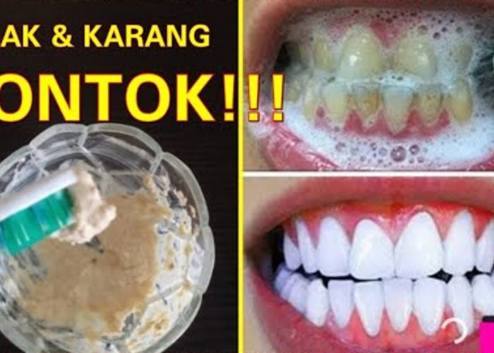 3 Cara Menghilangkan Karang Gigi yang Tebal Secara Alami, Cuma Pakai Bahan Dapur