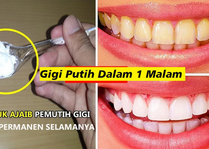 Bahannya Mudah Dicari, Begini Cara Cepat Memutihkan Gigi Secara Alami dalam 1 Hari, Gigi Bersih Bebas Plak 