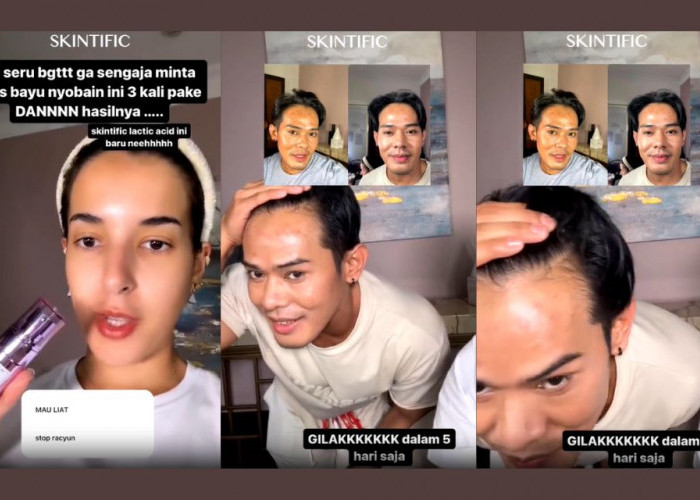 Ini Dia Serum untuk Menghilangkan Flek Hitam dan Menghaluskan Kulit dalam 5 Hari, Tasya Farasya Approved!