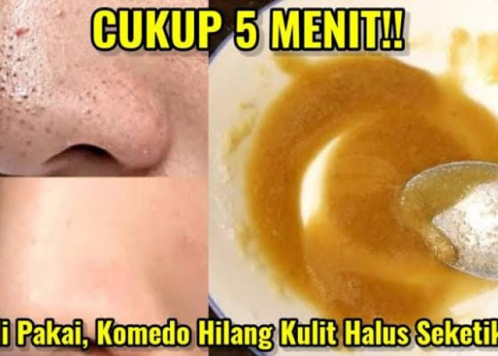 2 Masker Bahan Dapur Penghilang Komedo, Bantu Kecilkan Pori-Pori Bikin Wajah Mulus dan Glowing