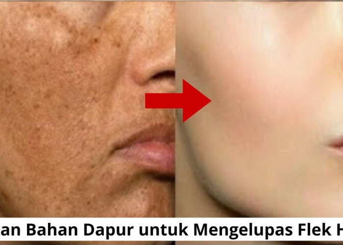 Racikan Bahan Dapur untuk Mengelupas Flek Hitam dengan Cepat, 2 Bahan Begini Cara Meraciknya