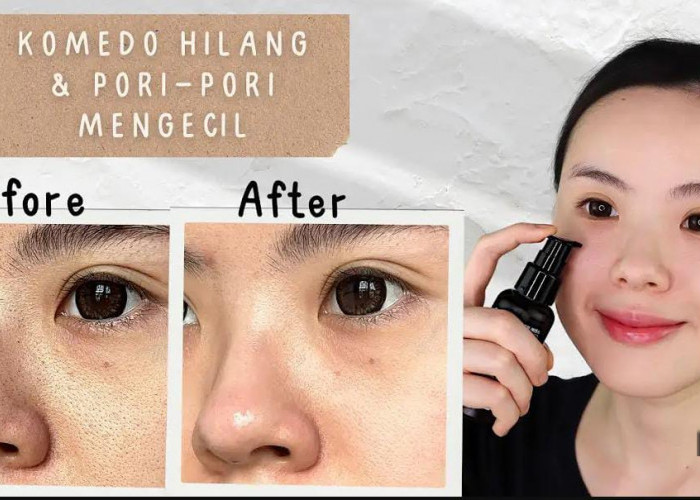 3 Skincare untuk Pori-Pori Besar dan Kusam Terbaik, Wajah Langsung Glowing Bebas Flek Hitam Modal 30 Ribuan