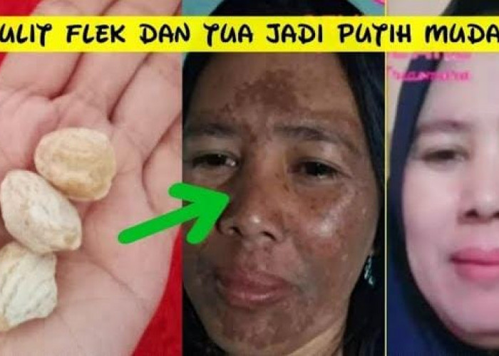 Inilah Masker Alami untuk Menghilangkan Flek Hitam Membandel, Cuma 1 Bahan Bikin Glowing Permanen