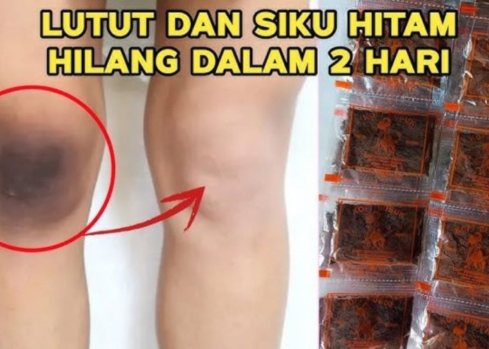 4 DIY Racikan untuk Mencerahkan Siku dan Lutut, Cobain Sendiri di Rumah!