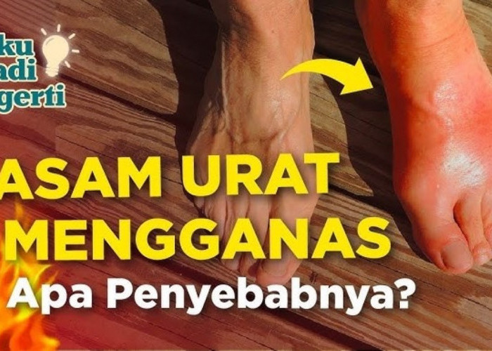 Sering Panasan Bisa Bikin Asam Urat? 7 Kebiasaan Buruk yang Bisa Menyebabkan Asam Urat yang Wajib Diketahui!