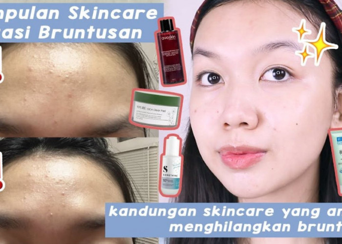 4 Rekomendasi Skincare untuk Bruntusan, Kontrol Minyak dan Bersihkan Pori-Pori 