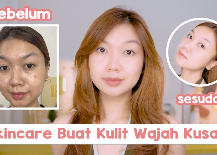 Review Jujur Serum Vitamin C Skintific untuk Mencerahkan Kulit, Bikin Kulit Wajah Glowing Merata