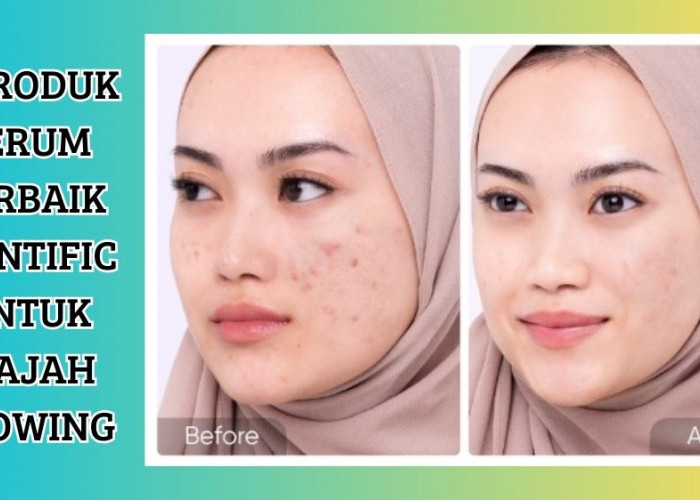 4 Produk Serum Terbaik Skintific agar Wajah Glowing, Mana yang Paling Cocok untuk Kulitmu?