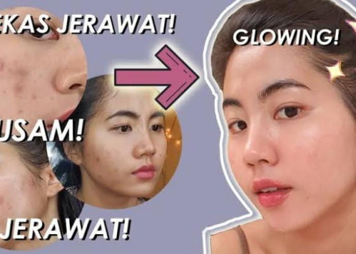 Inilah 6 Toner untuk Kulit Kering dan Kusam, Solusi Wajah Glowing Bebas Flek dan Bekas Jerawat Secara Instan