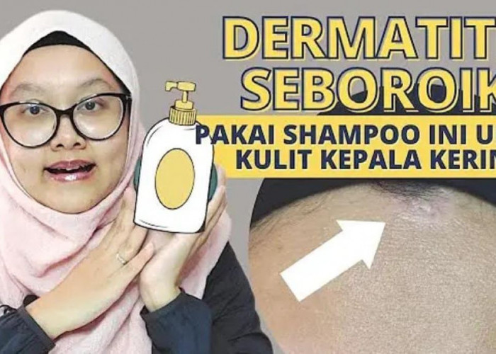 4 Rekomendasi Pilihan Shampo untuk Rambut Kering dan Rusak Terbaik, Modal 15 Ribu Ada di Indomaret