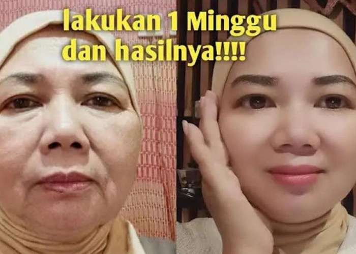 5 Cara Mengencangkan Kulit Kendur dengan Baby Oil, Bantu Samarkan Flek Hitam Dalam 1 Malam