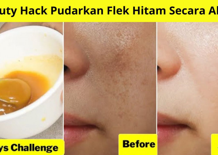 Beauty Hack Pudarkan Flek Hitam Secara Alami, Mengelupas Cuma Pakai 2 Bahan Dapur Ini