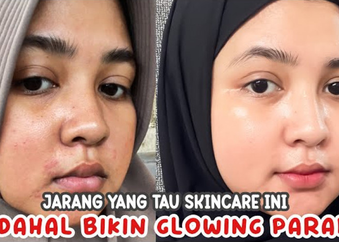 Cara Membuat Skincare Alami untuk Memutihkan Wajah Kusam dan Kering, Bikin Glowing Permanen Cuma 3 Langkah