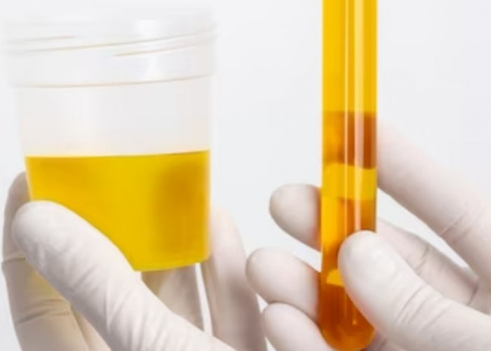 Berikut 5 Ciri-ciri Urine Sehat yang Menandakan Kalau Ginjal dalam Kondisi Baik-baik Saja