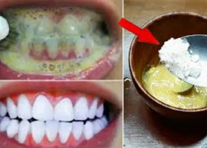 5 Cara Gampang Memutihkan Gigi dengan Bahan Alami Rumahan, Efektif Bersihkan Plak Hingga Rontokkan Karang Gigi