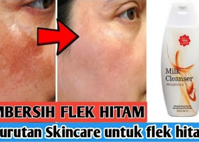 5 Rekomendasi Skincare Flek Hitam untuk Wajah Glowing, dari Pembersih Sampai Krim Malam Cepat Memutihkan!