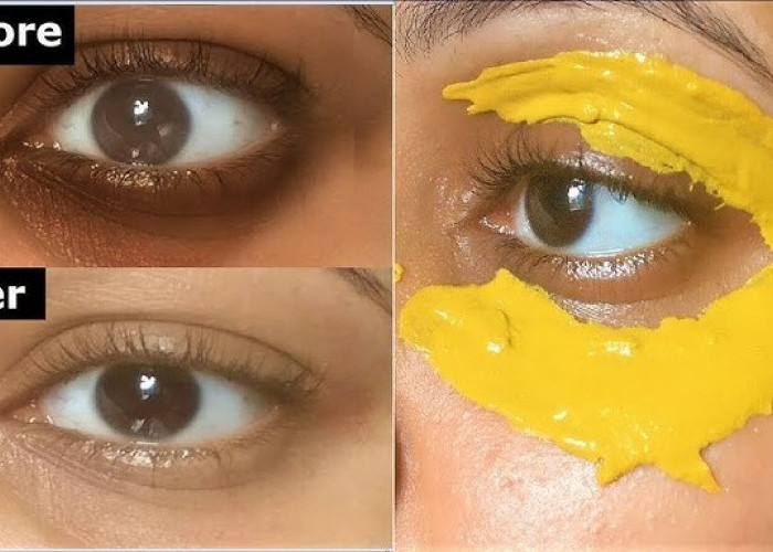 DIY Masker untuk Cerahkan Mata Panda, Dark Circle Hilang Permanen Cuma Pakai 3 Bahan Dapur Ini