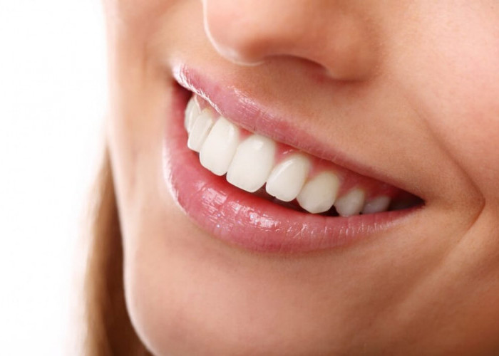 4 Cara Membersihkan Karang Gigi Sendiri di Rumah Secara Alami Ga Pakai Lama, Gigi Langsung Putih Bebas Bau