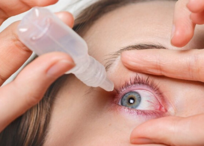 Terasa Gatal dan Kemerahan? Ini Dia 10 Merek Obat Tetes Mata Terbaik dan Terampuh di Apotek