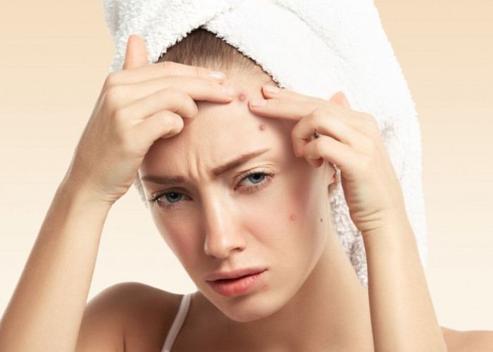 5 Penyebab Jerawat Selalu Muncul di Wajah Walaupun Rutin Pakai Skincare 