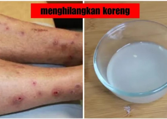 3 Cara Menghilangkan Bekas Hitam di Kaki yang Sudah Lama, Cuma Pakai Bahan Dapur yang ada Di Rumah