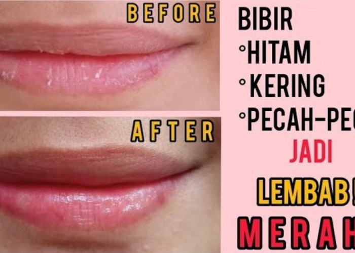 Cara Mengatasi Bibir Kering dan Pecah-Pecah Saat Puasa, Gunakan 2 Bahan Ini Bikin Merona Sekaligus 