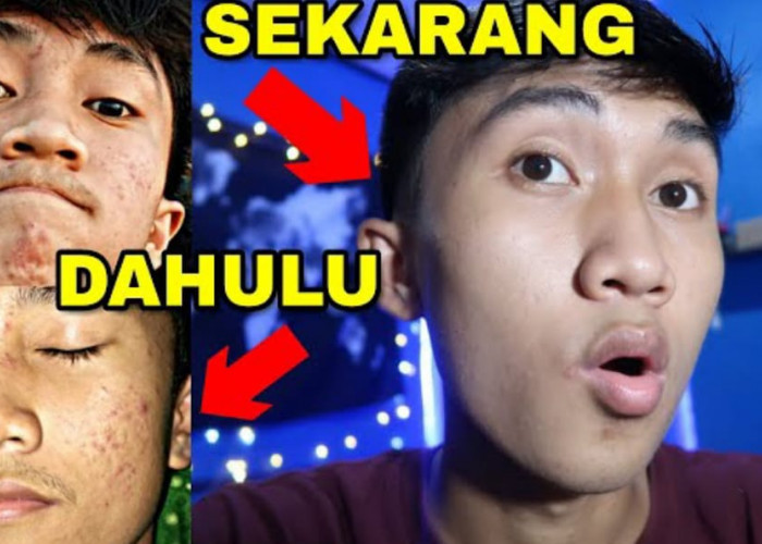 4 Sabun Cuci Muka untuk Kulit Berminyak Pria Terbaik, Ampuh Hilangkan Komedo dan Noda Hitam di Wajah