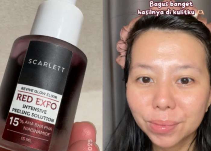 Review Jujur Peeling Solution Scarlett: Eksfoliasi Persentase Tinggi, Rasanya Agak Cekat Cekit tapi..