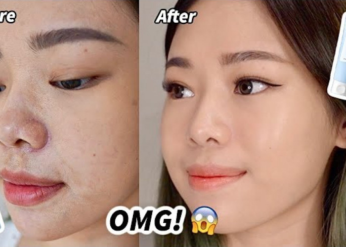 4 Rekomendasi Skincare untuk Kulit Kering dan Kusam ala Molita Lin, Rahasia Awet Muda di Usia 30 Tahun