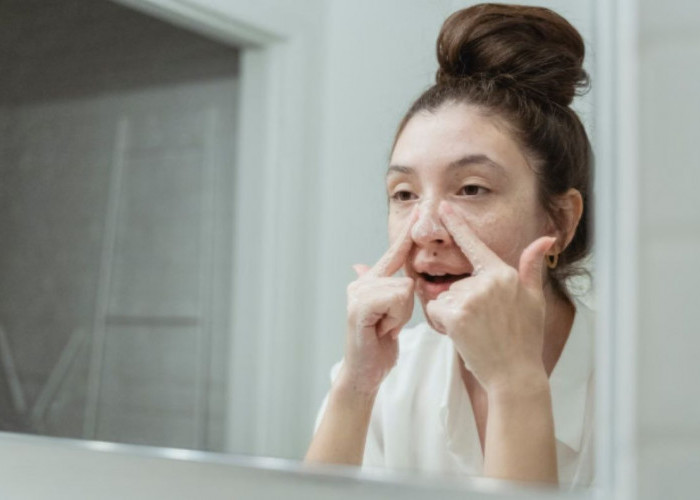 5 Skincare yang Direkomendasikan untuk Kulit Sensitif, Nggak Takut Kemerahan!