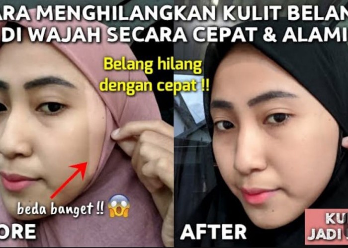 4 Cara Menghilangkan Belang di Muka Dengan Bahan Dapur, Hilangkan Noda Hitam Kulit jadi Glowing Pakai 1 Bahan