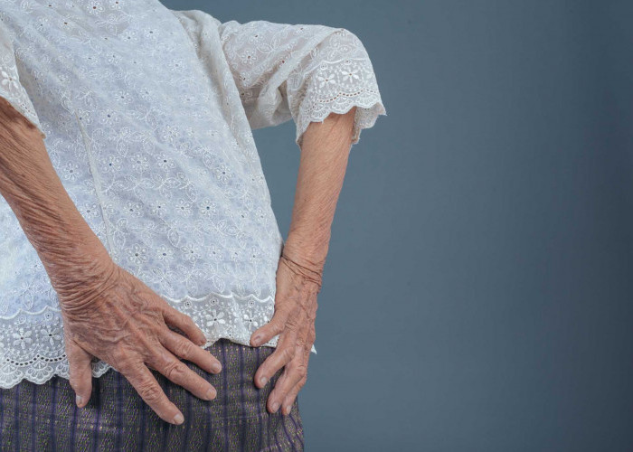 Inilah Kebiasaan yang Menyebabkan Osteoporosis, Hati-hati Dapat Membuat Tulangmu Keropos!
