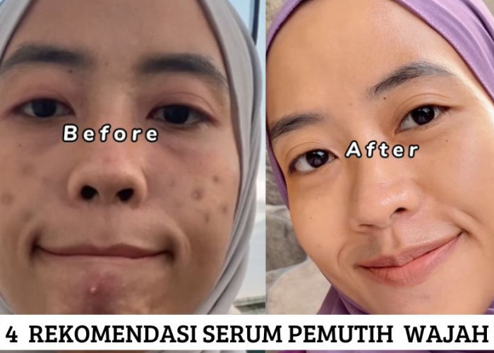 4 Rekomendasi Serum Pemutih Wajah, Cocok untuk Kulit Kusam Penuh Flek Hitam Agar Glowing Merata